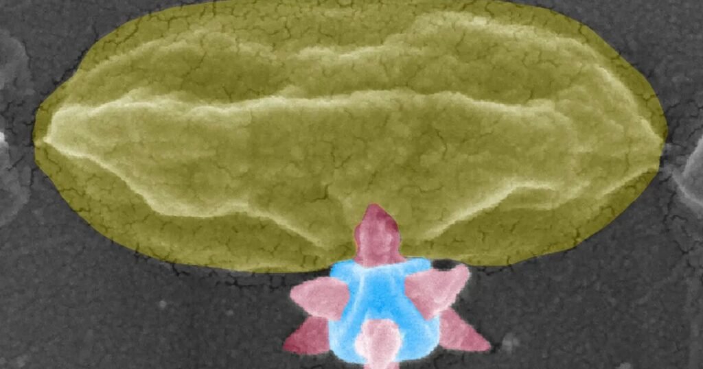 Tiny metal structures kill bacteria with sharp spikes